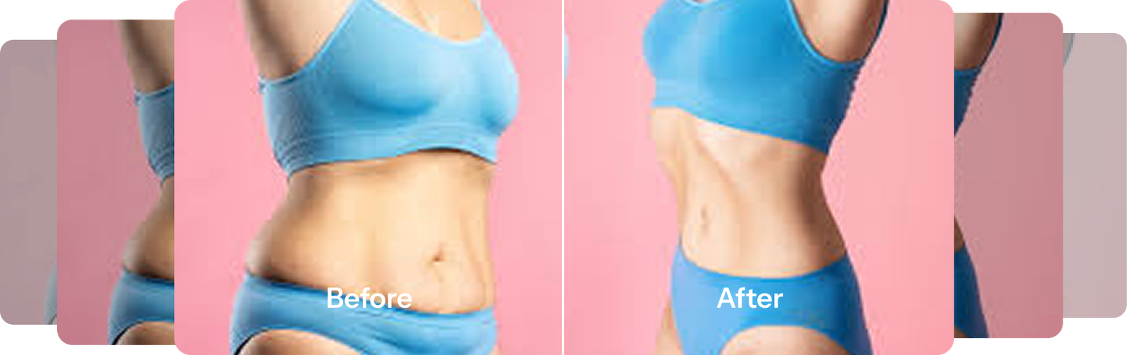 before after